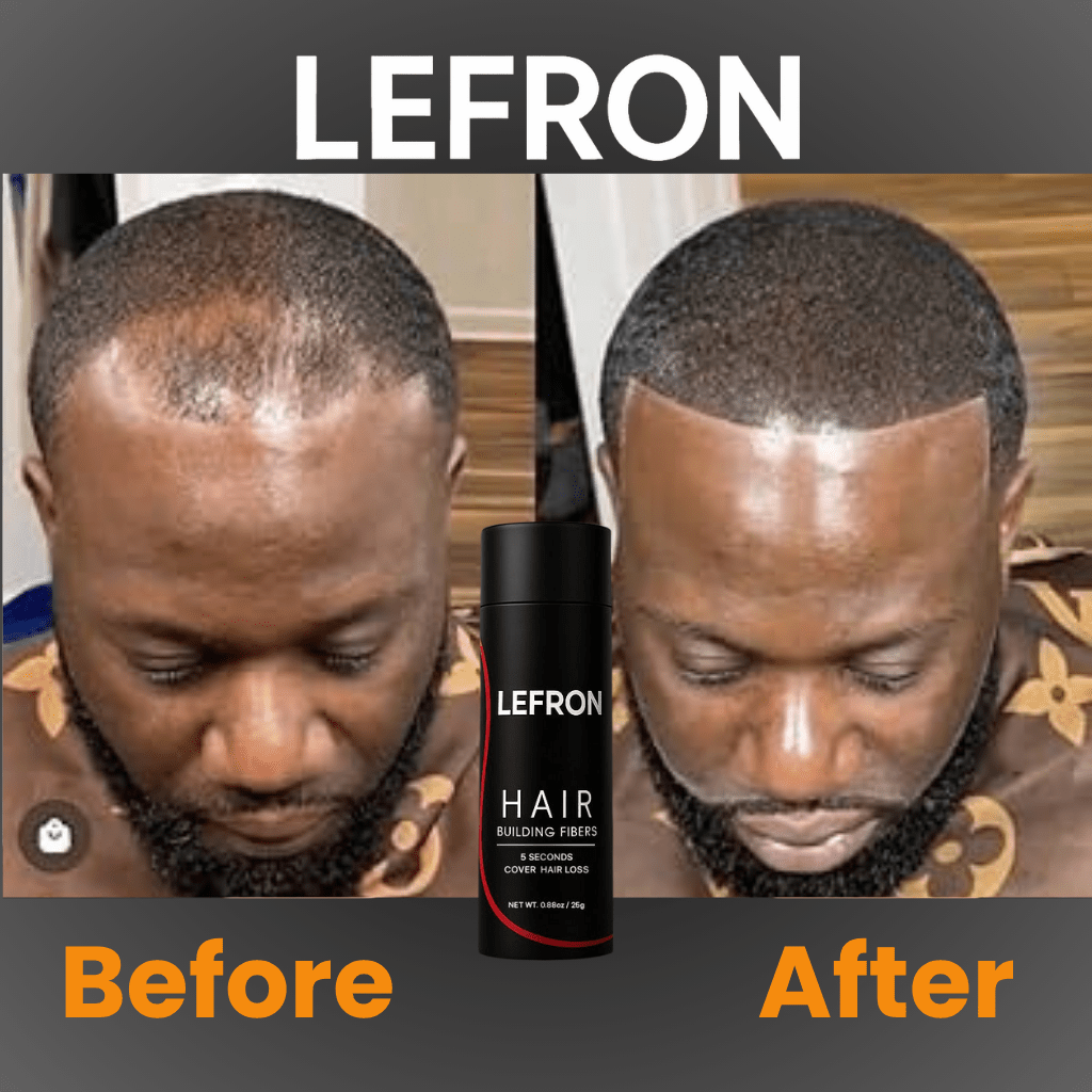 Lefron™ 1 Hair Building Fibers - Lefron