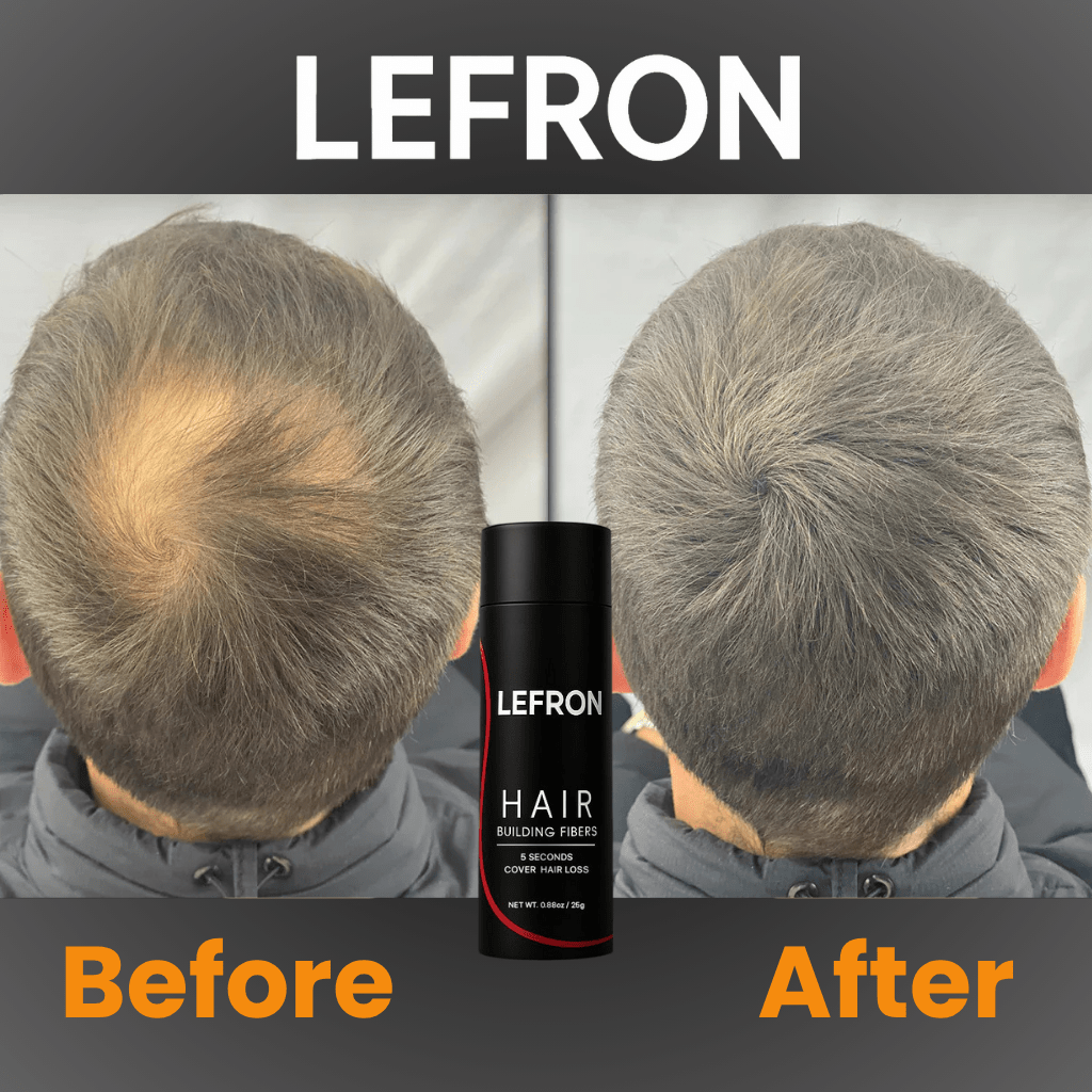 Lefron™ 1 Hair Building Fibers - Lefron