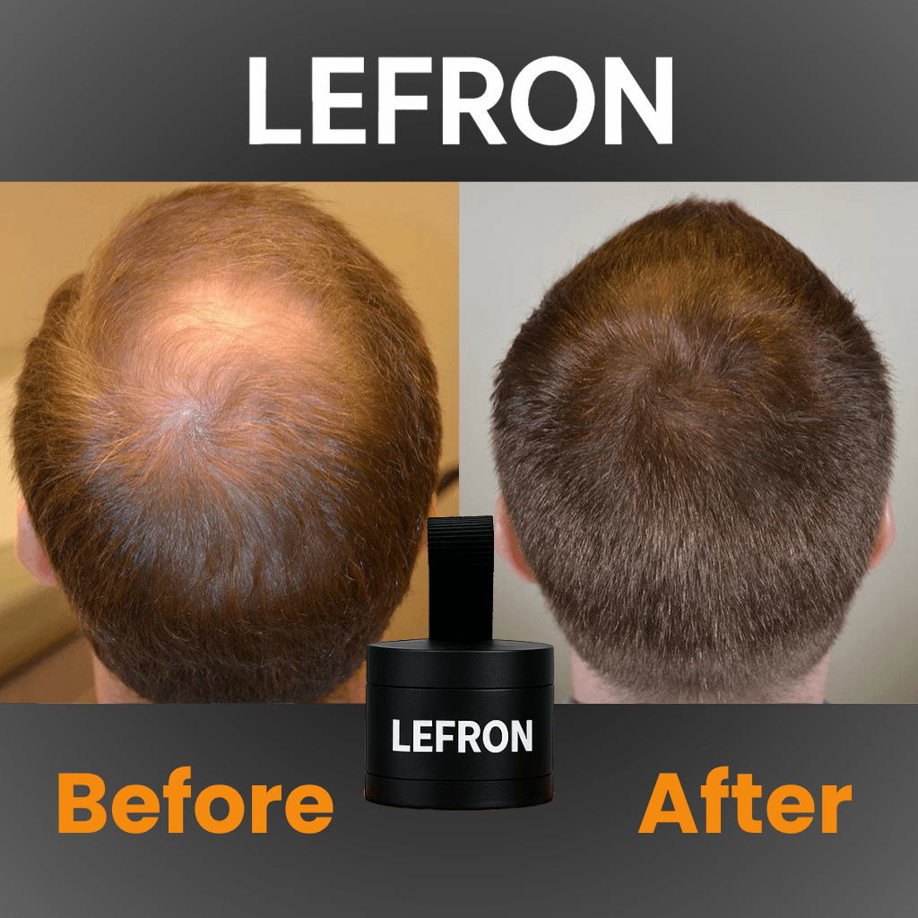 Lefron™ 1 Hair Thickening Powder - Lefron