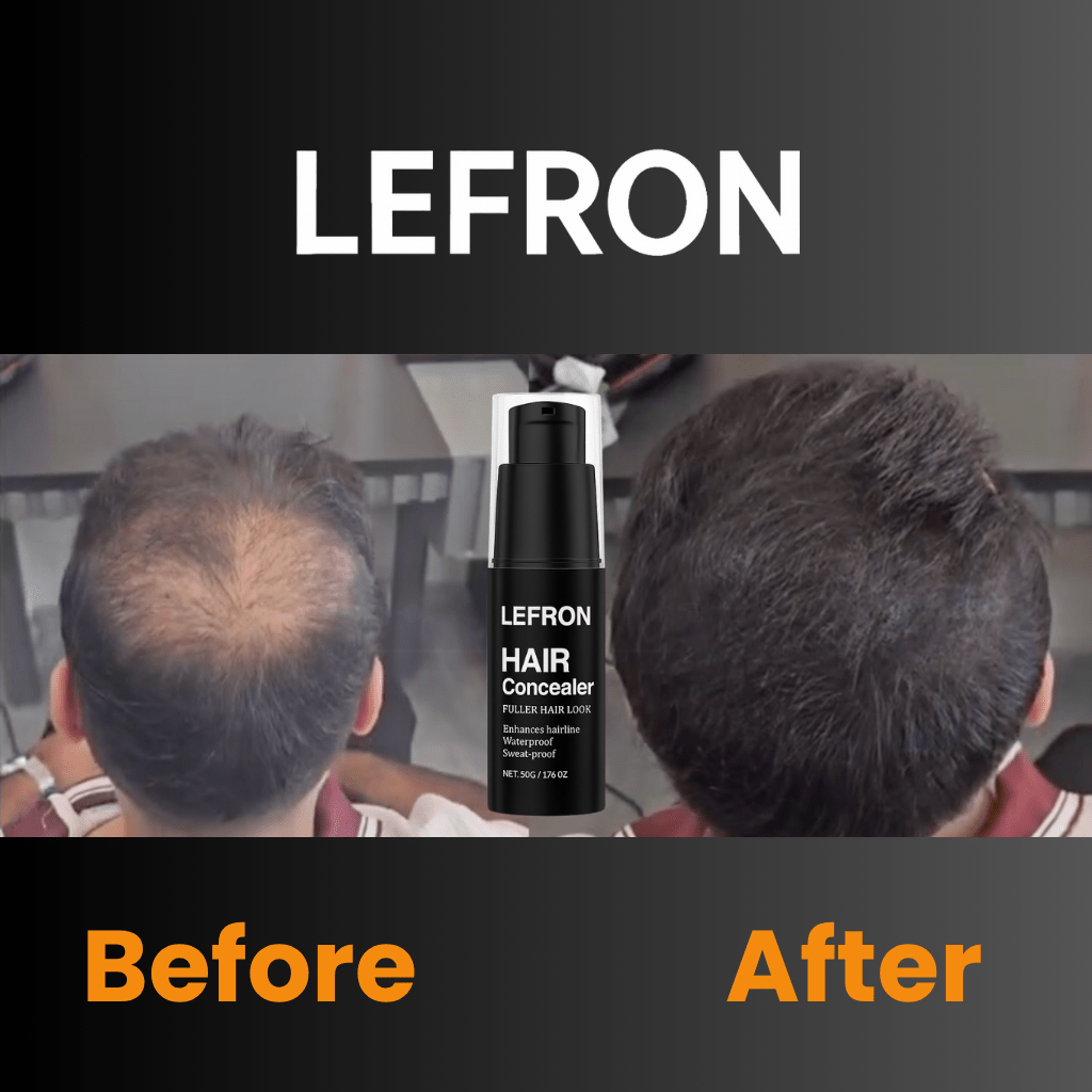 Lefron™ 1 Magic Hair Concealer Cream - Lefron