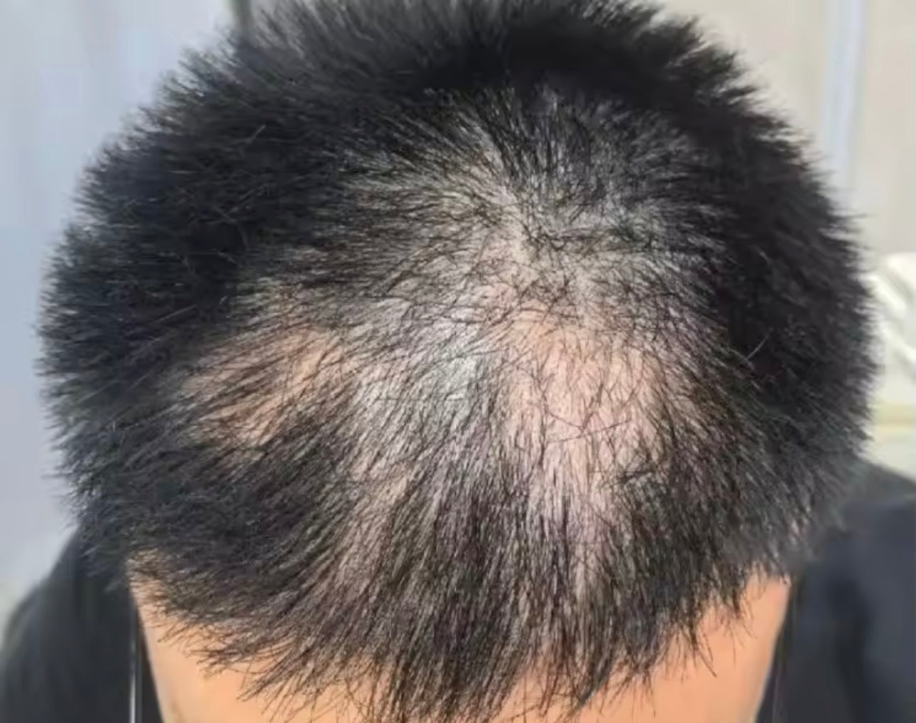 Lefron™ Magic Hair Concealer 3.0