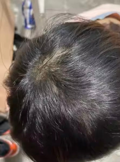 Lefron™ Magic Hair Concealer 3.0