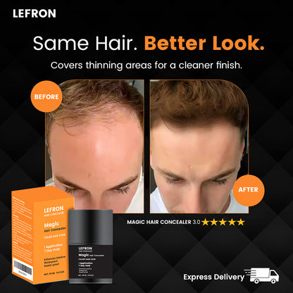 Lefron™ Magic Hair Concealer 3.0
