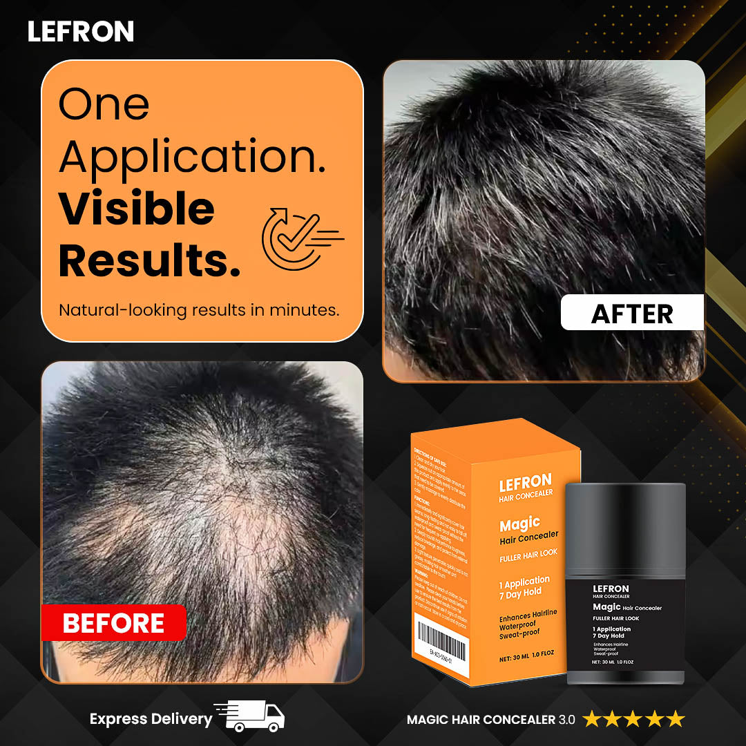 Lefron™ Magic Hair Concealer 3.0