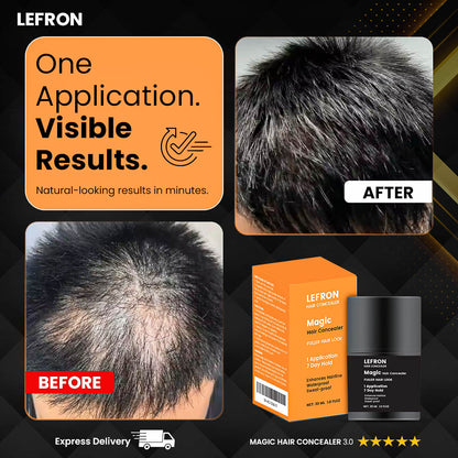 Lefron™ Magic Hair Concealer 3.0