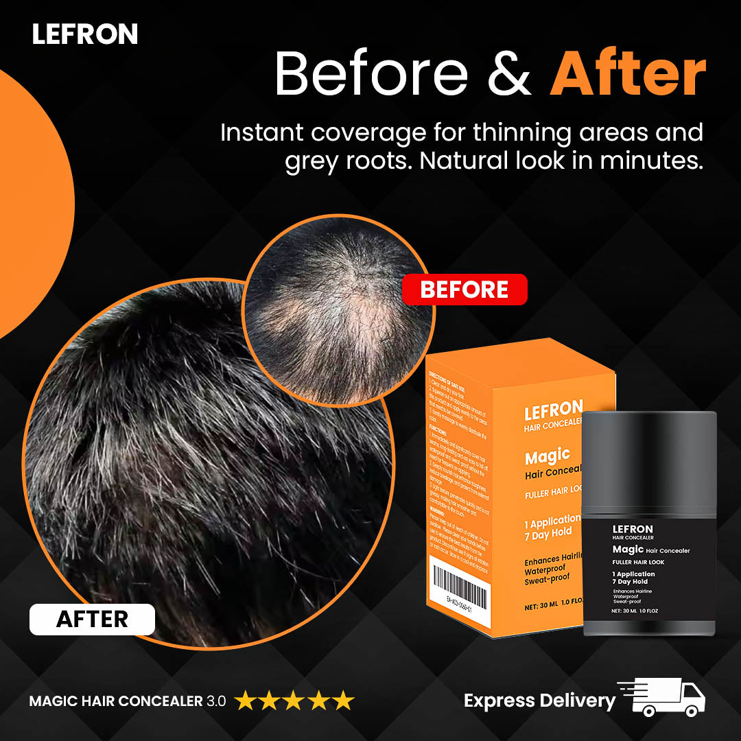 Lefron™ Magic Hair Concealer 3.0