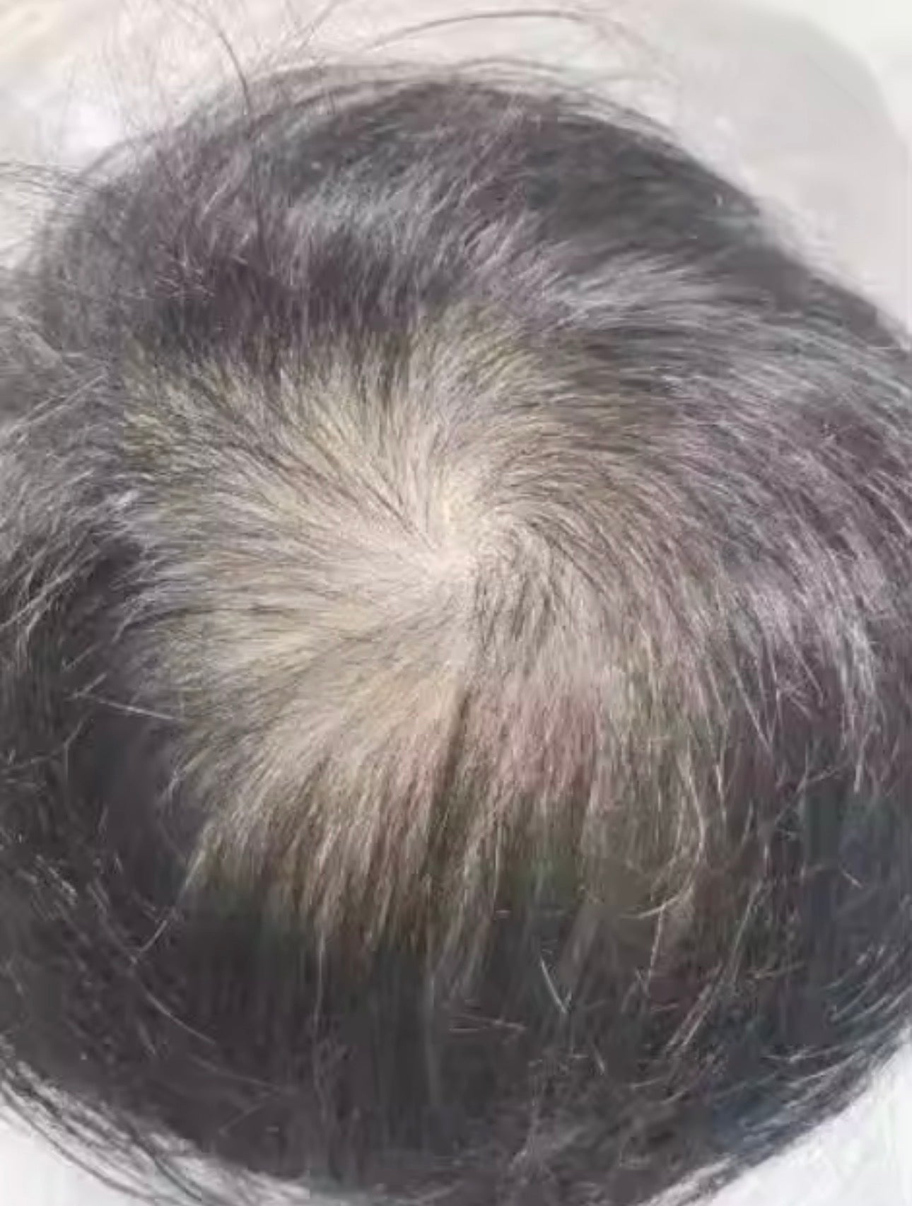 Lefron™ Magic Hair Concealer 3.0