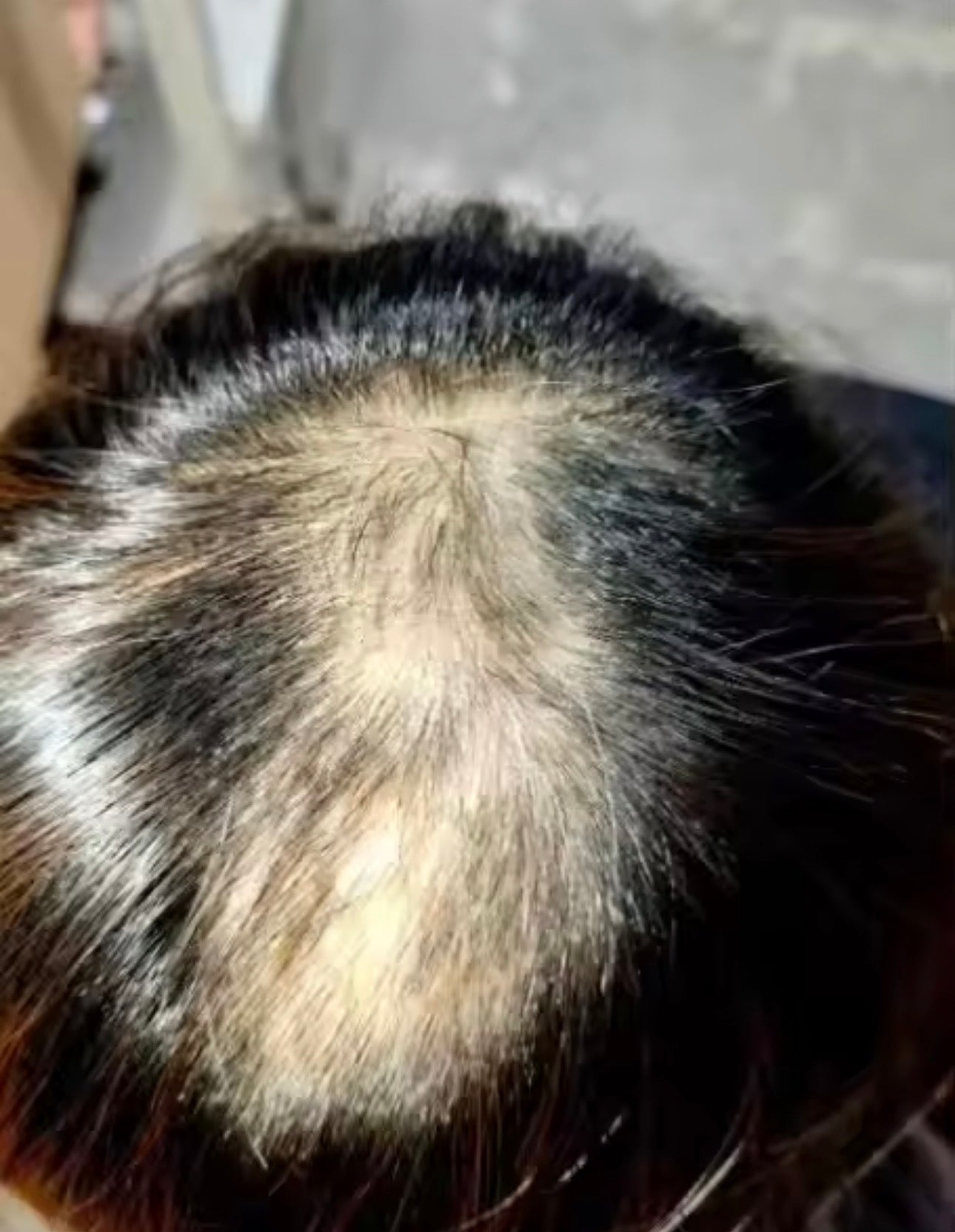 Lefron™ Magic Hair Concealer 3.0