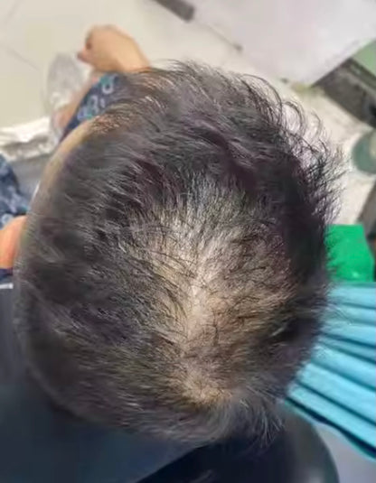 Lefron™ Magic Hair Concealer 3.0