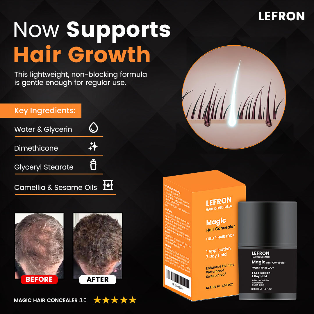 Lefron™ Magic Hair Concealer 3.0