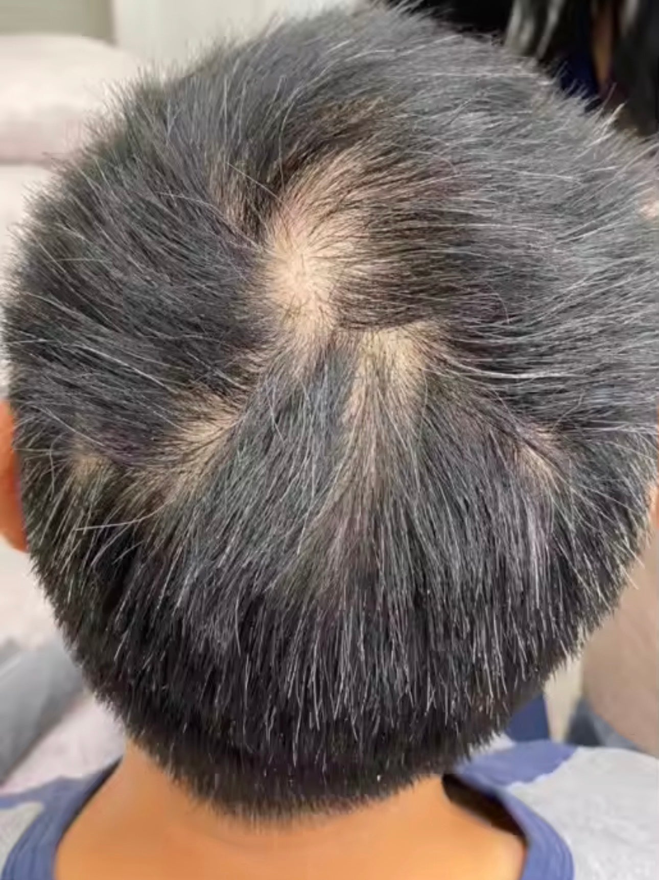 Lefron™ Magic Hair Concealer 3.0