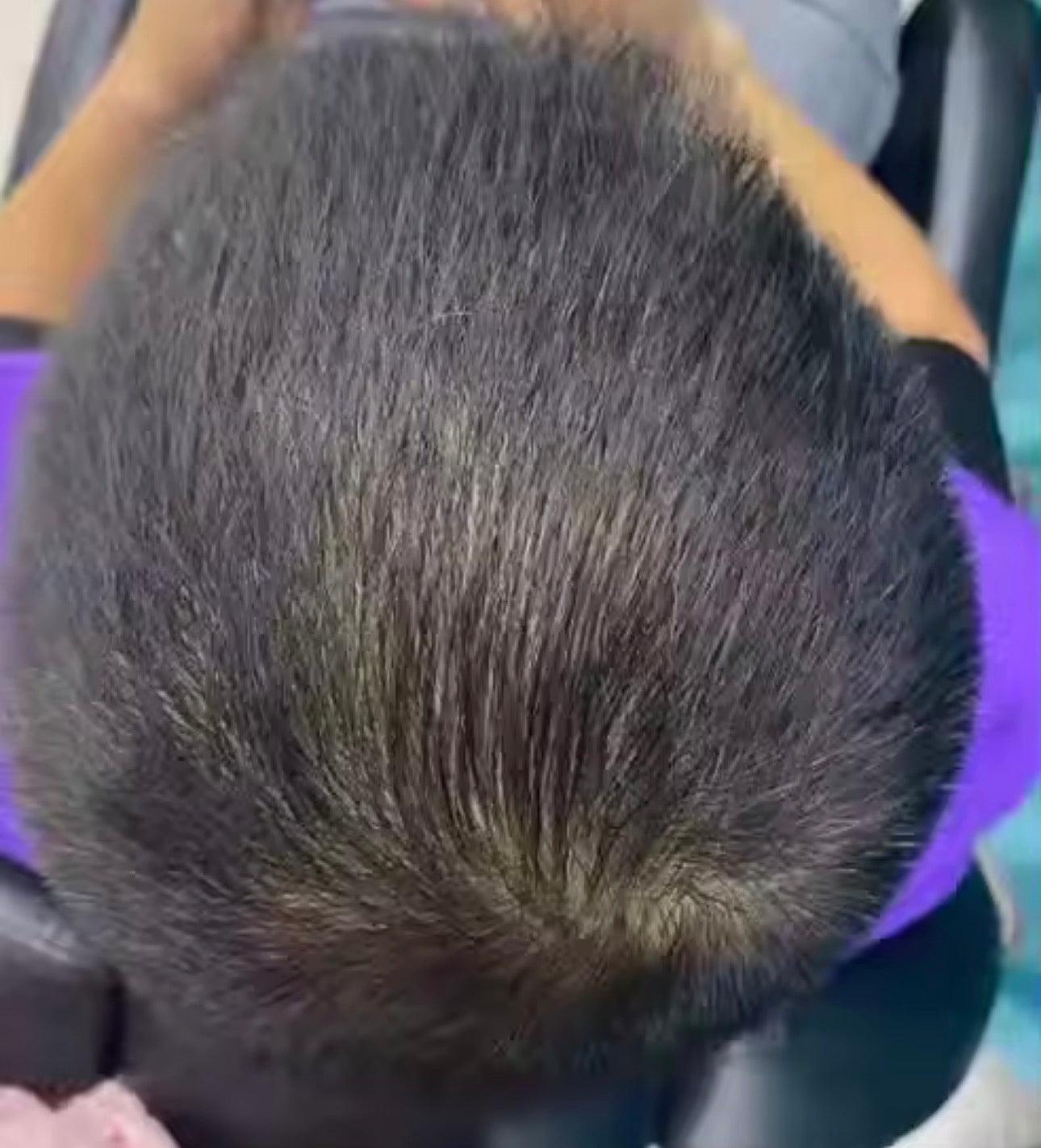 Lefron™ Magic Hair Concealer 3.0