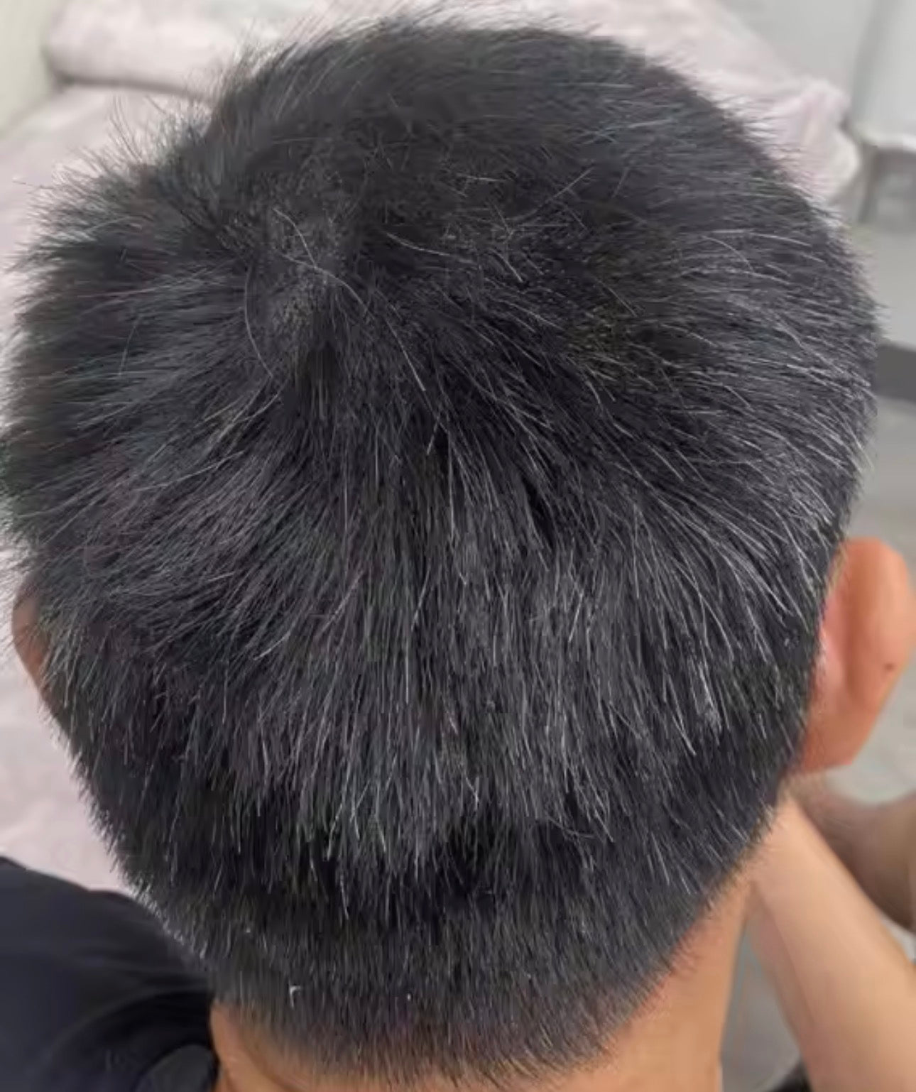 Lefron™ Magic Hair Concealer 3.0