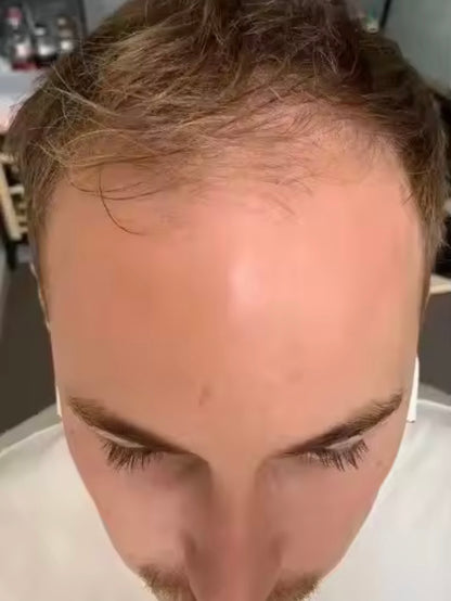 Lefron™ Magic Hair Concealer 3.0