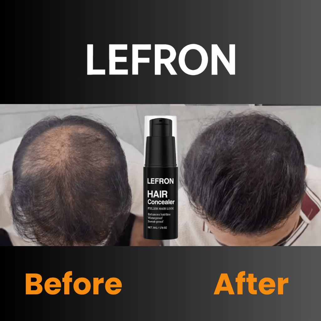 Lefron™ 1 Magic Hair Concealer Cream - Lefron
